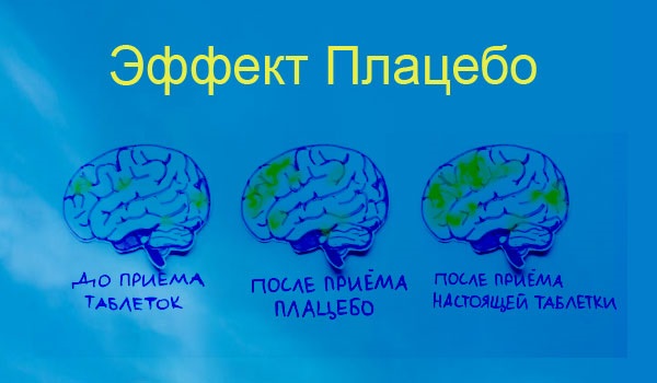 Плацебо эффект: что это такое, список препаратов, метод плацебо наоборот