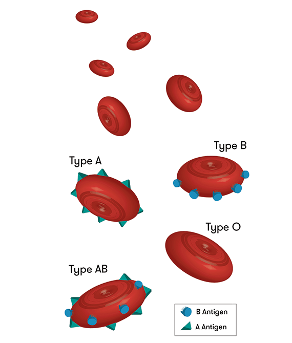 A diagram showing how the antigens on red blood cells determine blood type. Cells with A antigens on them give type A blood; cells with A antigens on them give type B blood; cells with both A and B antigens on them give AB blood; and cells with neither A nor B antigen on them give type O blood.